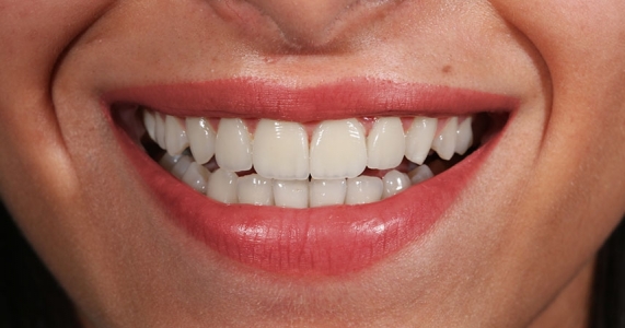 Cosmetic Dentistry